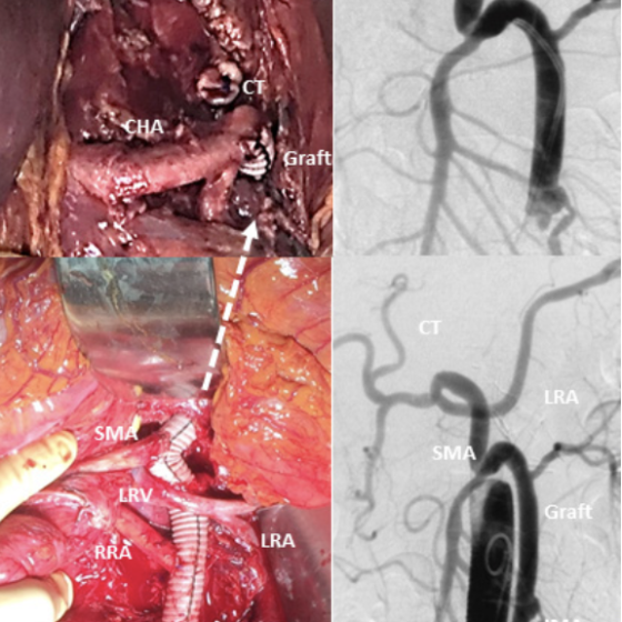 Photo of heart surgery