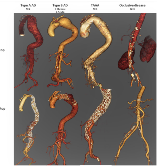Before and after heart operations